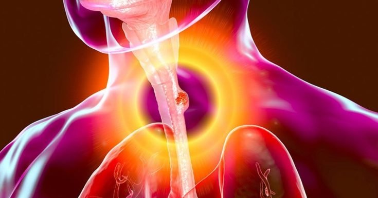 9bd70350474ceff8161fbc45d062d2e8